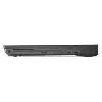 ноутбук Lenovo ThinkPad L570 20J80020RT